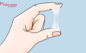 Huyết trắng khi nào là bình thường? Thế nào là bệnh lý?