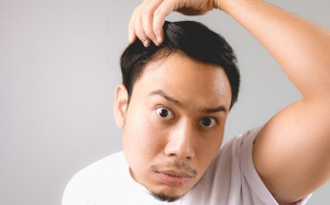 9 dấu hiệu hói đầu cần biết trước khi quá muộn
