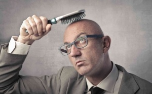 6 quan niệm sai lầm về hói đầu nhiều người mắc phải