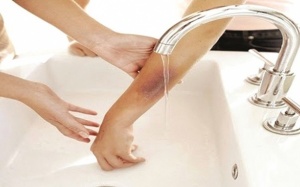 Mẹo hay trị bỏng nhẹ bằng các biện pháp tự nhiên mà không để lại sẹo