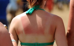 Video: Các loại tinh dầu xoa dịu làn da cháy nắng