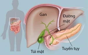 Người bị viêm xơ đường mật ăn uống thế nào để quản lý bệnh?