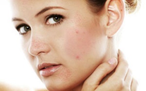 10 thói quen xấu gây bít tắc lỗ chân lông