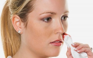 Có nên ngừng sử dụng aspirin khi bị chảy máu cam không?