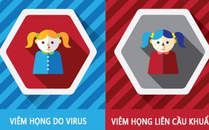 Đau họng như thế nào mới uống thuốc kháng sinh? 