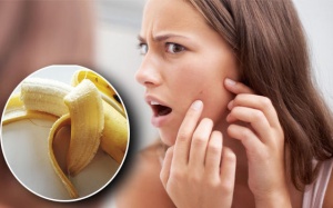 Hướng dẫn cách dùng vỏ chuối để chăm sóc da