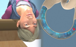 Chóng mặt, ù tai và nghe kém là bệnh gì?