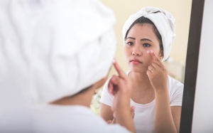 Cách kết hợp các sản phẩm trị mụn trứng cá hiệu quả nhất