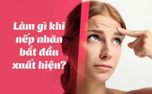 Infographic: Phải làm gì khi da bạn bắt đầu xuất hiện nếp nhăn? 