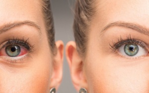 Loại protein tự nhiên này có thể ngăn mù lòa do tăng nhãn áp