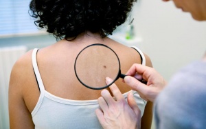 Những dấu hiệu trên da cảnh bảo bạn đang mắc bệnh