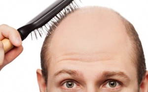 Video: Vì sao tóc rụng nhiều và hói đầu khi già?