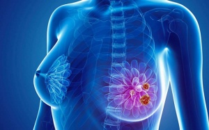 8 bệnh viện Việt Nam tầm soát ung thư vú miễn phí cho phụ nữ từ 40 tuổi