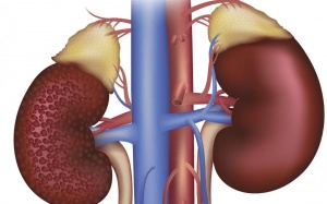 Bạn biết gì về bệnh thận đái tháo đường?