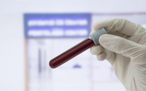 Tăng nồng độ clo máu: Nguy hiểm nhưng không được quan tâm đúng mức