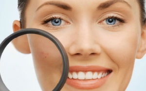 Mẹo hay giúp loại bỏ vết thâm trên da mặt