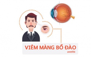 Viêm màng bồ đào nguy hiểm tới mức nào?