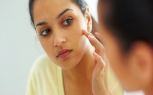 8 cách tự nhiên 'đánh bay' mụn trứng cá hiệu quả