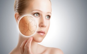 5 biện pháp tự nhiên dưỡng ẩm da vào mùa Đông ngay tại nhà 