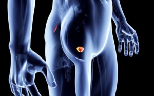 Những điều cần biết về ung thư tuyến tiền liệt