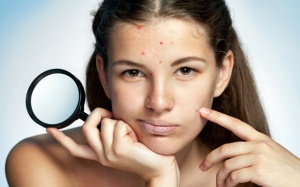 Những điều nên làm và không nên làm khi điều trị mụn trứng cá