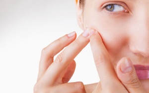 Trị mụn trứng cá bằng các loại mặt nạ tự nhiên