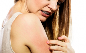 Da ngứa ngáy, cảm giác như kiến bò: Do suy giảm hormone