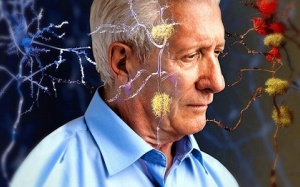 Nấu ăn bằng xoong, chảo nhôm gây sa sút trí tuệ, Alzheimer?