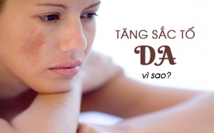 Vì sao bạn bị nám da, sạm da?