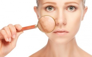 7 vấn đề về sức khoẻ có thể làm tăng sắc tố da