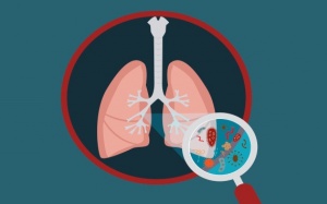 4 dưỡng chất giúp ngăn ngừa bệnh viêm phổi