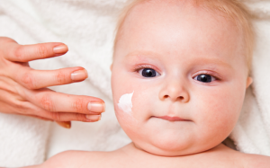 5 vấn đề về da thường gặp ở trẻ nhỏ trong mùa Đông