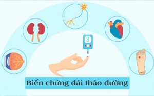 5 biến chứng đái tháo đường thường gặp nhất