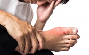 Đau nhức bàn chân nhưng không sưng có phải là gout?