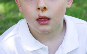 Trẻ bị chốc đừng vội uống kháng sinh, hãy áp dụng các phương pháp tự nhiên