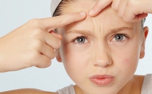 5 bước giúp con bạn đối phó với mụn trứng cá