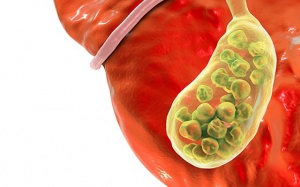 Điều gì sẽ xảy ra khi túi mật có vấn đề?