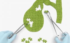 6 lời khuyên giúp phòng ngừa sỏi mật, giữ túi mật khỏe mạnh