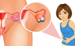 5 chế độ ăn uống để giảm nguy cơ ung thư buồng trứng 