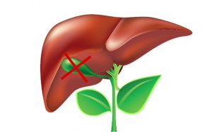 Liệu bạn có thể sống tốt mà không có túi mật?