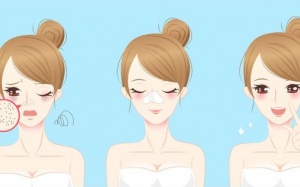 Tự làm mặt nạ tự nhiên trị mụn đầu trắng tại nhà