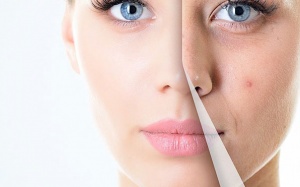 Muốn chống lão hóa da: Đừng quên alpha lipoic acid và selen