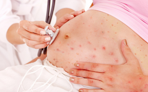 Phụ nữ mang thai bị thủy đậu ảnh hưởng gì đến trẻ?