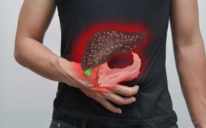 Tại sao bạn cần cảnh giác với viêm gan, viêm túi mật?