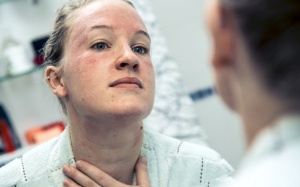 7 cách giúp bạn đối phó với eczema trên mặt