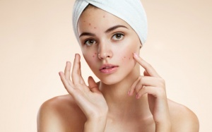 9 quan điểm sai lầm về mụn trứng cá