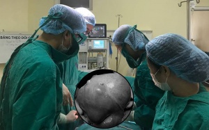 Cứu sống nữ bệnh nhân mang khối u cổ tử cung nặng 7kg