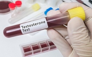 Nên kiểm tra nồng độ testosterone vào thời điểm nào?
