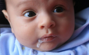 Bé bị nôn trớ nhiều: Nên làm gì để giúp con? 