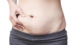 Bí quyết khắc phục tình trạng da chảy xệ, nhăn nheo sau sinh